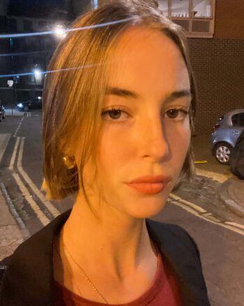 🔥 Amelie manzoli  page leaked private photo uncensored full