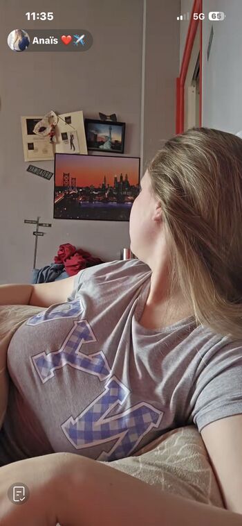 🔥 Anais page leaked private photo uncensored full