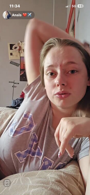 🔥 Anais page leaked private photo uncensored full