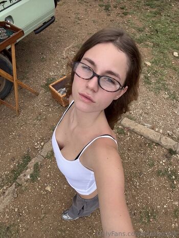 🔥 Anna malygn  page leaked private photo uncensored full