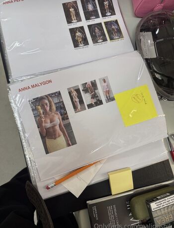 🔥 Anna malygn  page leaked private photo uncensored full