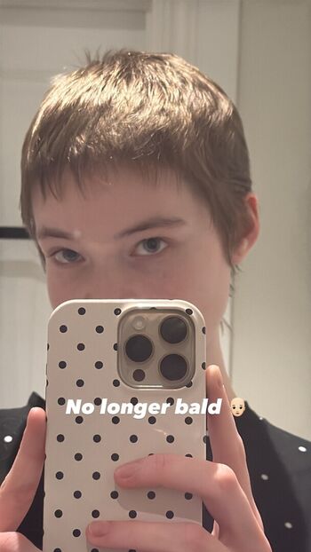 🔥 Chloerannoch leaked private photo uncensored full