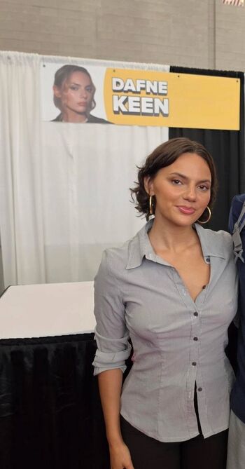 🔥 Dafne keen  page leaked private photo uncensored full