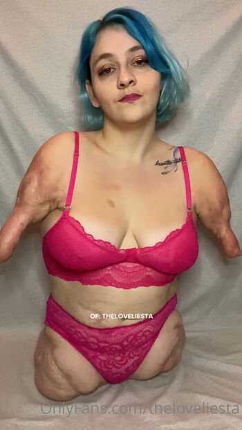 🔥 Disabled girls page leaked private photo uncensored full