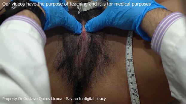 🔥 Dr gustavo quiros licona page leaked private photo uncensored full