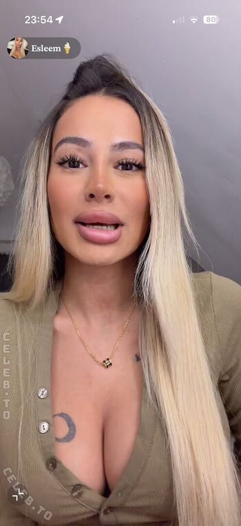 🔥 Esleem leaked private photo uncensored full