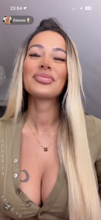 🔥 Esleem leaked private photo uncensored full