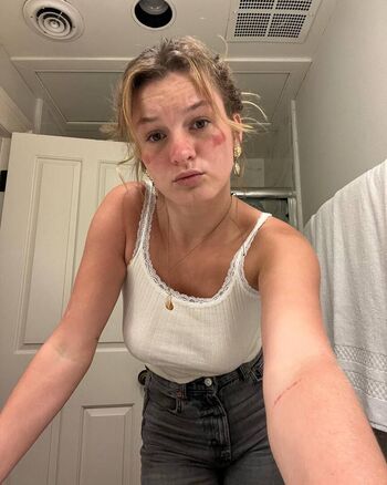🔥 Itscarlyjane  page leaked private photo uncensored full