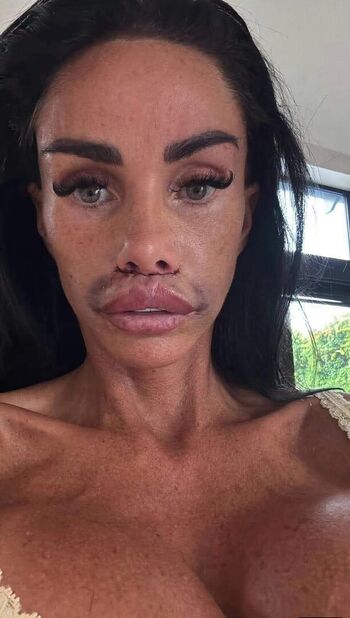🔥 Katie price leaked private photo uncensored full