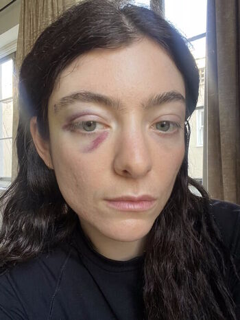 🔥 Lorde leaked private photo uncensored full