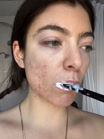 🔥 Lorde leaked private photo uncensored full