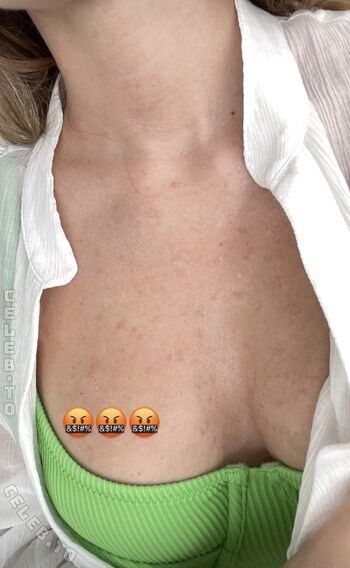 🔥 Mrs bella page leaked private photo uncensored full