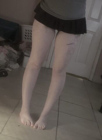 🔥 Sickndcute leaked private photo uncensored full