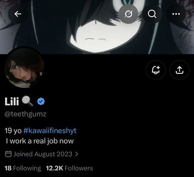 🔥 Teethgumz leaked private photo uncensored full