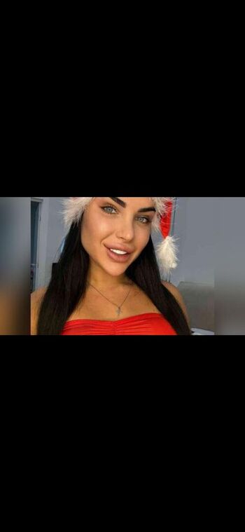 🔥 Ukraine mega page leaked private photo uncensored full