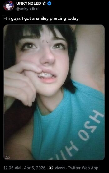 🔥 Unkyndled leaked private photo uncensored full