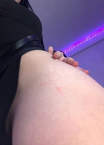 🔥 Your koda page leaked private photo uncensored full